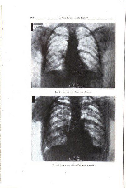 Lotta contro la tubercolosi rivista mensile