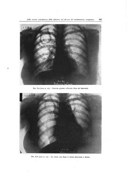 Lotta contro la tubercolosi rivista mensile