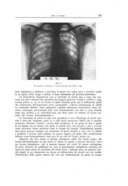 Lotta contro la tubercolosi rivista mensile