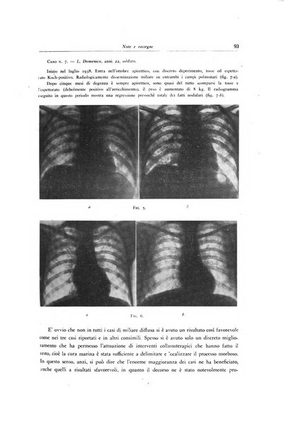 Lotta contro la tubercolosi rivista mensile