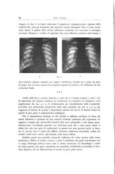 Lotta contro la tubercolosi rivista mensile