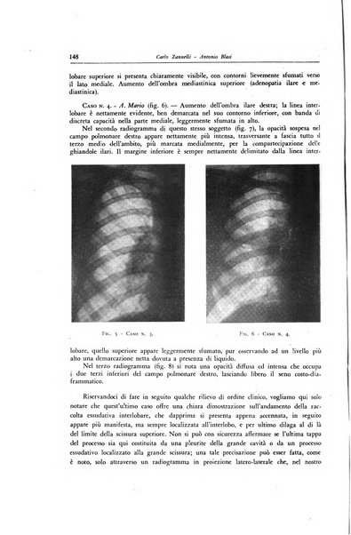 Lotta contro la tubercolosi rivista mensile