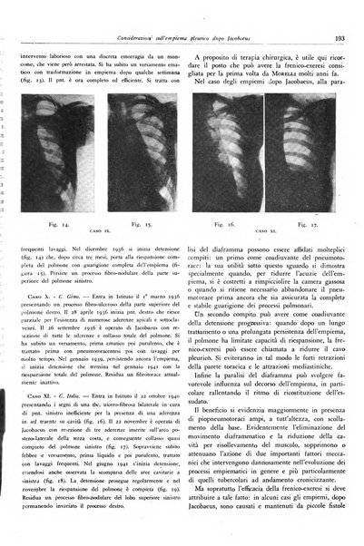 Lotta contro la tubercolosi rivista mensile