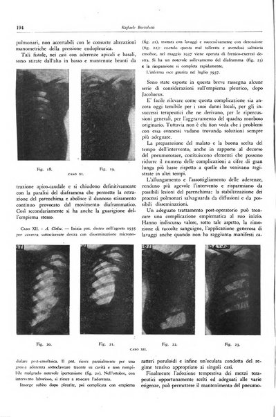 Lotta contro la tubercolosi rivista mensile