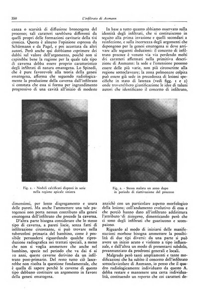 Lotta contro la tubercolosi rivista mensile