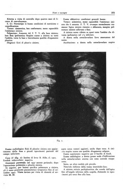 Lotta contro la tubercolosi rivista mensile