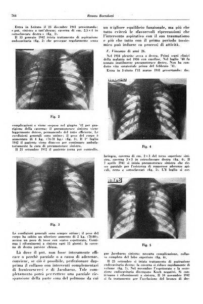 Lotta contro la tubercolosi rivista mensile