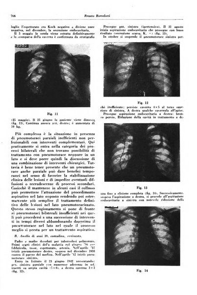 Lotta contro la tubercolosi rivista mensile