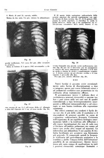 Lotta contro la tubercolosi rivista mensile