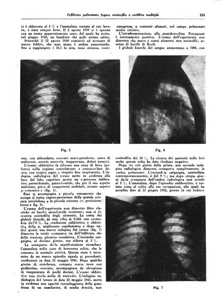 Lotta contro la tubercolosi rivista mensile