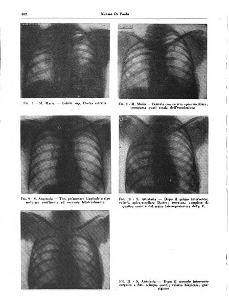 Lotta contro la tubercolosi rivista mensile