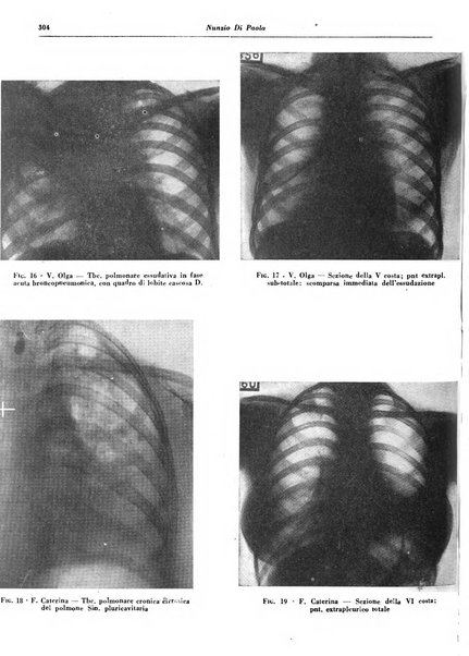 Lotta contro la tubercolosi rivista mensile