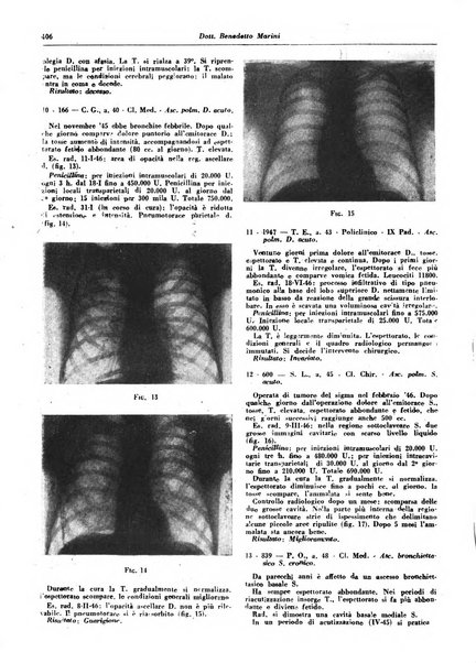 Lotta contro la tubercolosi rivista mensile