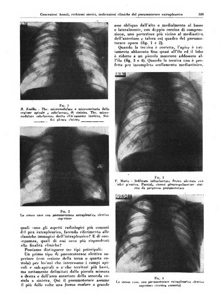 Lotta contro la tubercolosi rivista mensile