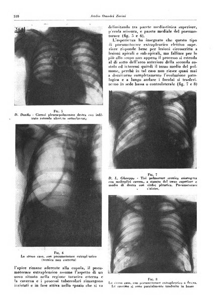 Lotta contro la tubercolosi rivista mensile