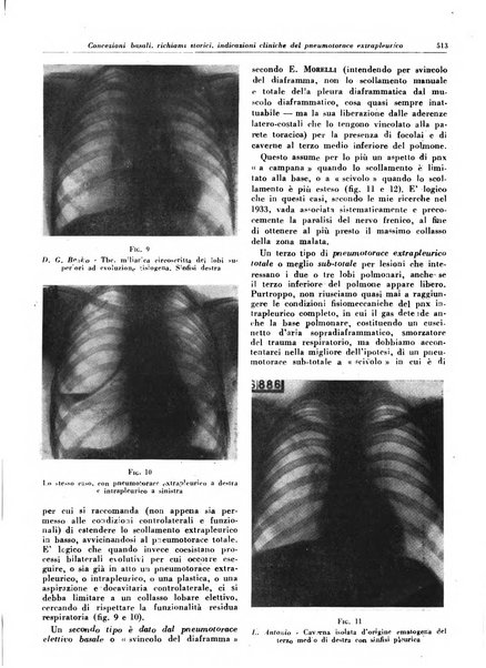 Lotta contro la tubercolosi rivista mensile