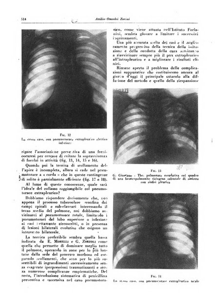 Lotta contro la tubercolosi rivista mensile