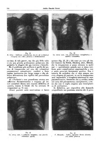 Lotta contro la tubercolosi rivista mensile