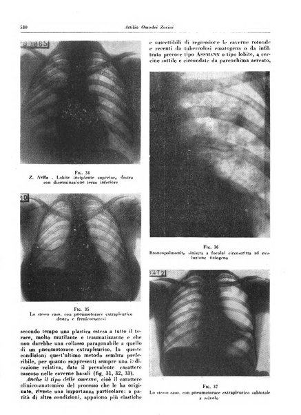 Lotta contro la tubercolosi rivista mensile