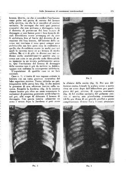 Lotta contro la tubercolosi rivista mensile