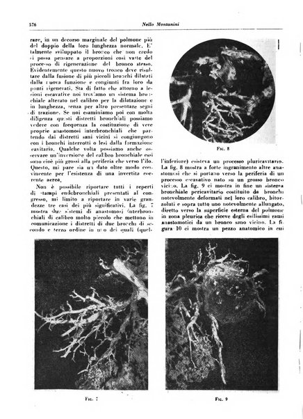 Lotta contro la tubercolosi rivista mensile