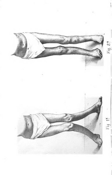 Il Morgagni opera di medicina e chirurgia