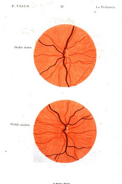 La pediatria periodico mensile indirizzato al progresso degli studi sulle malattie dei bambini