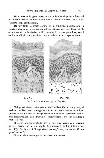 La pediatria periodico mensile indirizzato al progresso degli studi sulle malattie dei bambini