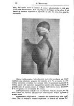 giornale/TO00190801/1914/unico/00000072