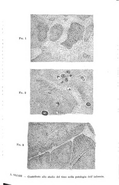 La pediatria periodico mensile indirizzato al progresso degli studi sulle malattie dei bambini