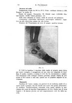 giornale/TO00190801/1915/unico/00000056