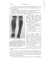 giornale/TO00190801/1915/unico/00000154