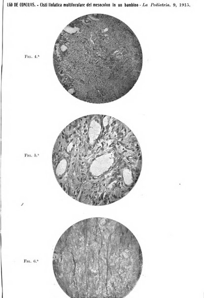 La pediatria periodico mensile indirizzato al progresso degli studi sulle malattie dei bambini