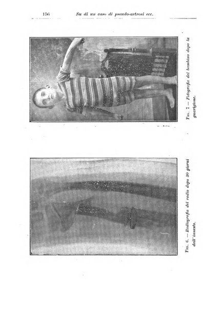 La pediatria periodico mensile indirizzato al progresso degli studi sulle malattie dei bambini