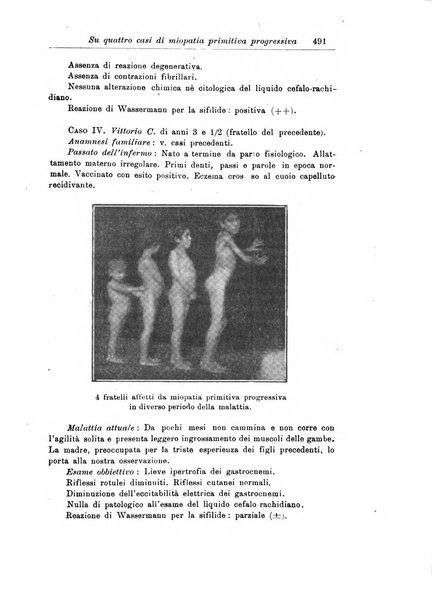 La pediatria periodico mensile indirizzato al progresso degli studi sulle malattie dei bambini