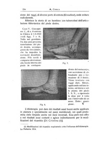 La pediatria periodico mensile indirizzato al progresso degli studi sulle malattie dei bambini