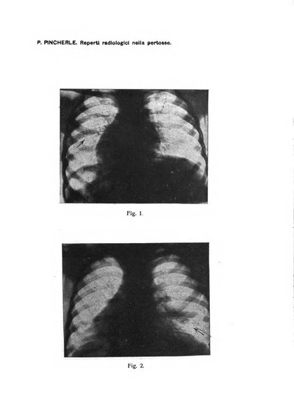 La pediatria periodico mensile indirizzato al progresso degli studi sulle malattie dei bambini