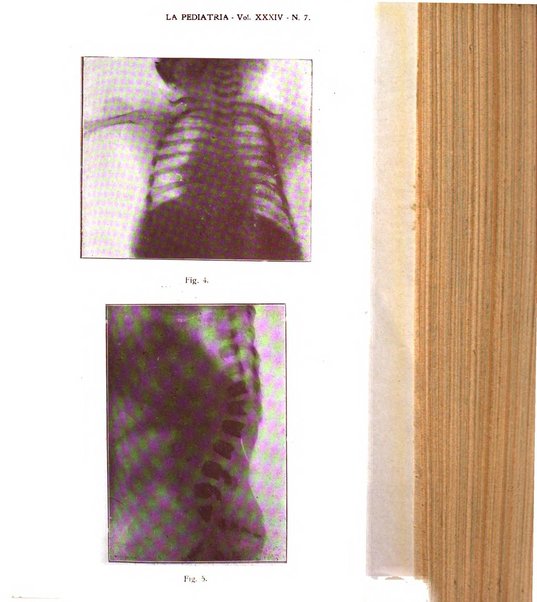 La pediatria periodico mensile indirizzato al progresso degli studi sulle malattie dei bambini