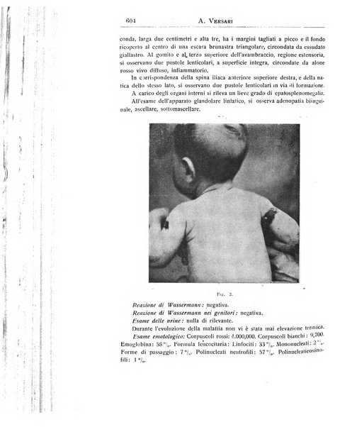 La pediatria periodico mensile indirizzato al progresso degli studi sulle malattie dei bambini