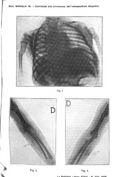 La pediatria periodico mensile indirizzato al progresso degli studi sulle malattie dei bambini