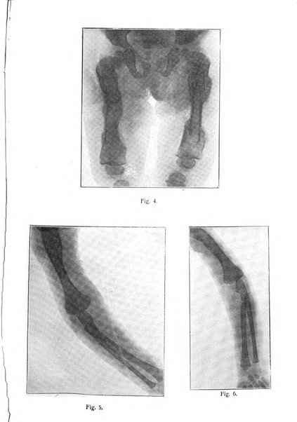 La pediatria periodico mensile indirizzato al progresso degli studi sulle malattie dei bambini