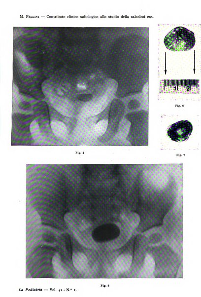 La pediatria periodico mensile indirizzato al progresso degli studi sulle malattie dei bambini