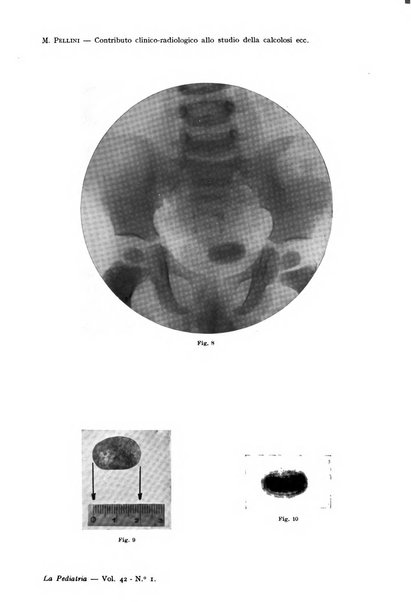 La pediatria periodico mensile indirizzato al progresso degli studi sulle malattie dei bambini