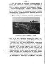 giornale/TO00191180/1915/unico/00000428