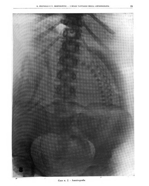 Quaderni di radiologia rivista di collaborazione clinico-radiologica fondata da M. Lapenna