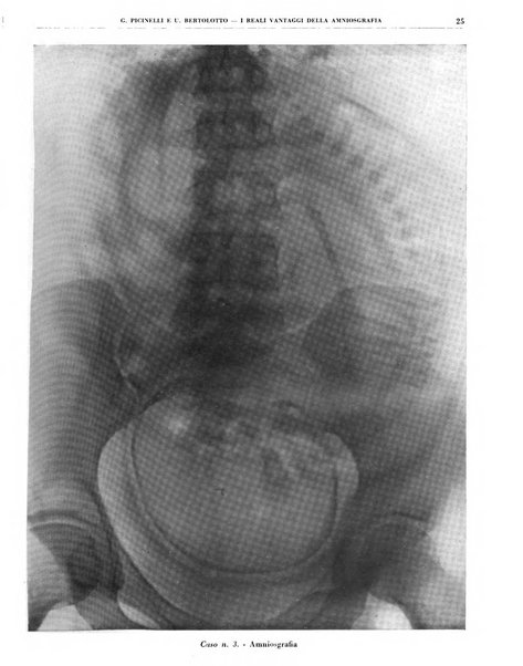 Quaderni di radiologia rivista di collaborazione clinico-radiologica fondata da M. Lapenna