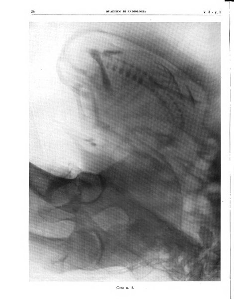 Quaderni di radiologia rivista di collaborazione clinico-radiologica fondata da M. Lapenna