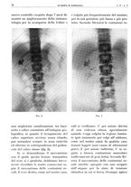 giornale/TO00191959/1938/V.1/00000084