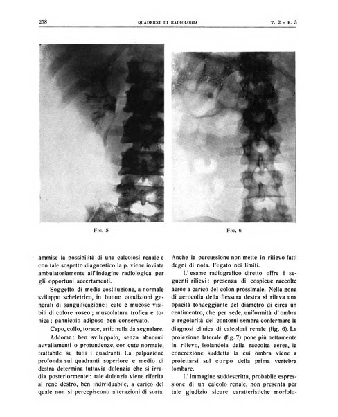 Quaderni di radiologia rivista di collaborazione clinico-radiologica fondata da M. Lapenna