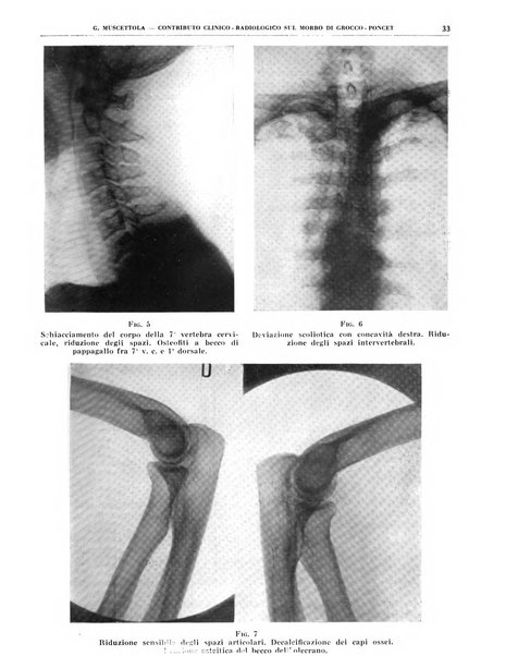 Quaderni di radiologia rivista di collaborazione clinico-radiologica fondata da M. Lapenna